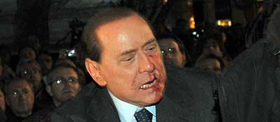 Berlusconi sofreu uma fratura no nariz, diz porta-voz do governo