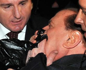 Imagem de Berlusconi após ser agredido por Tartaglia